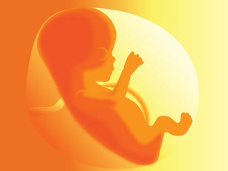 Open Fetal Surgery by OrangeCountySurgeons.org  (2)